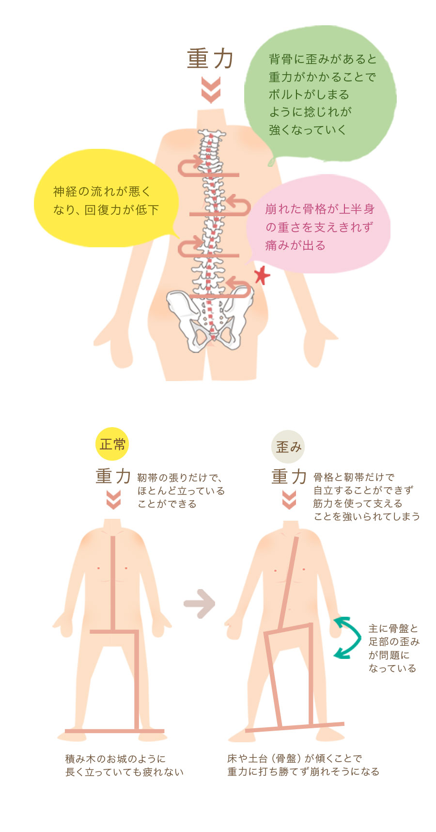 重力による歪み