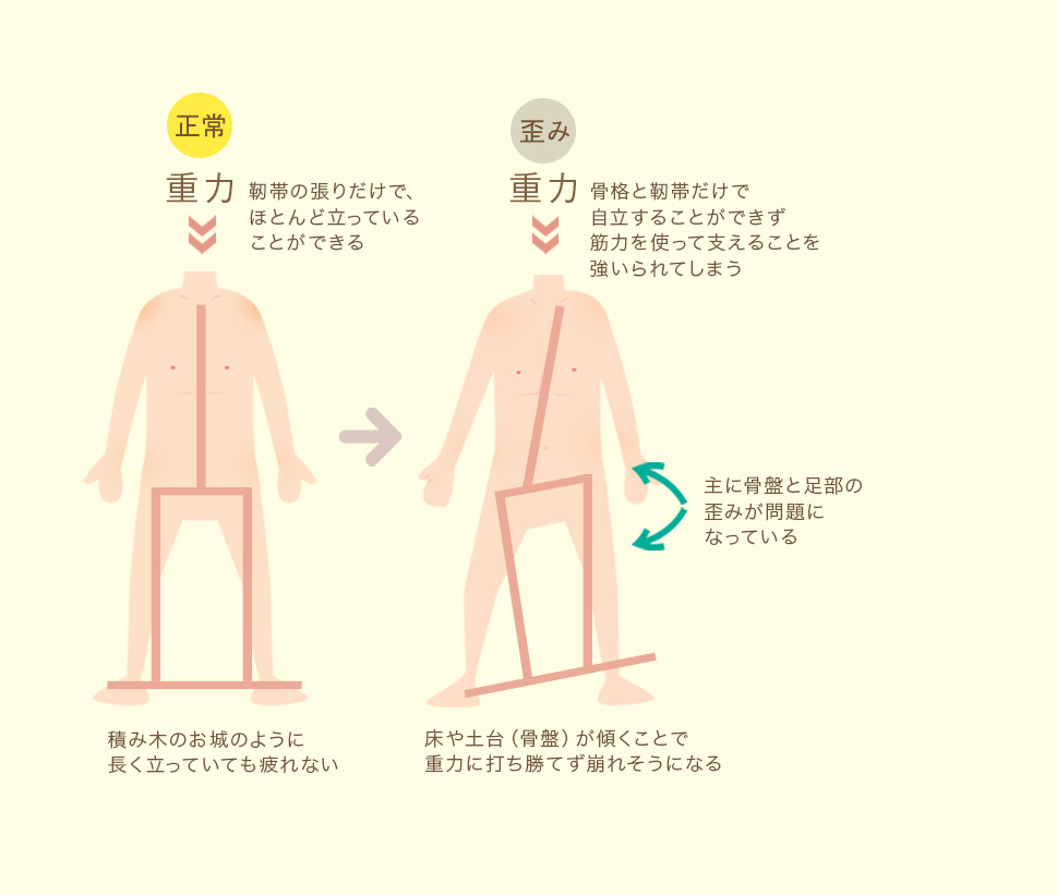 重力で歪む図