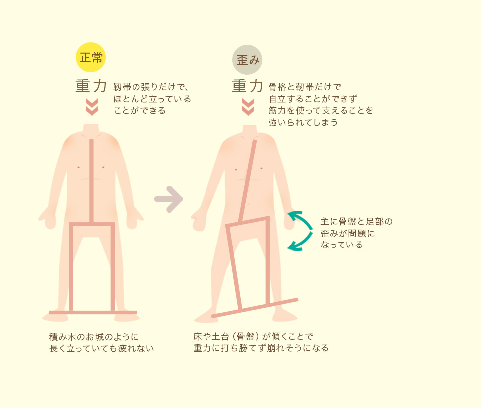 重力で歪む図