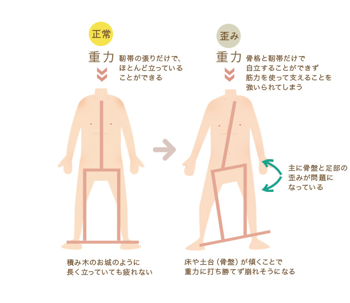 重力で歪む図